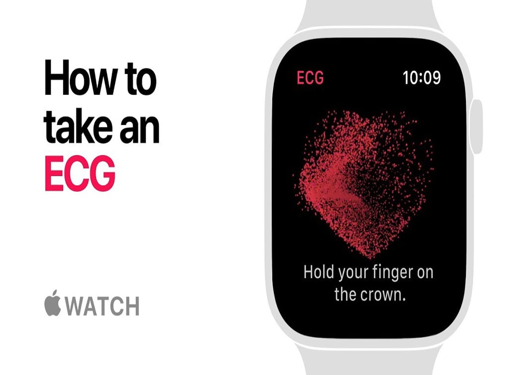 Apple Watch EKG